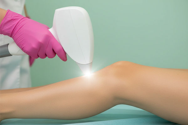 تحلیل پزشکی و نظر متخصصان سوختگی بع از لیزر