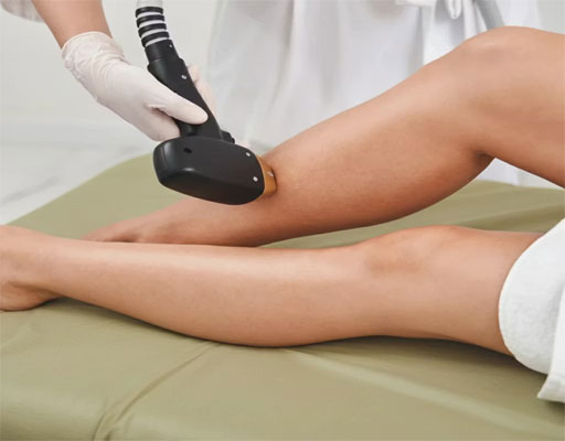 لیزر و سرطان